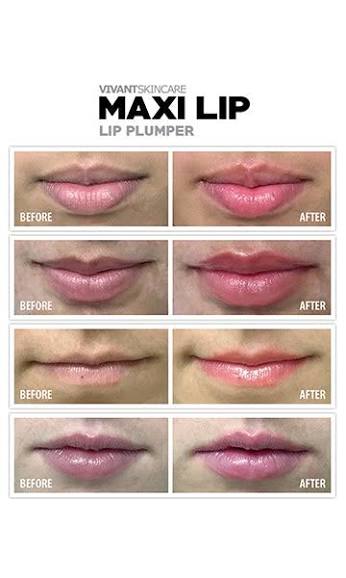 Maxi lip plumper